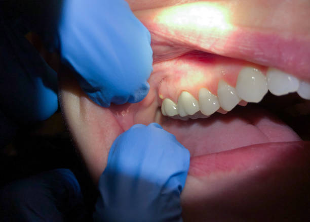 Reliable RI Emergency Dental Service Solutions